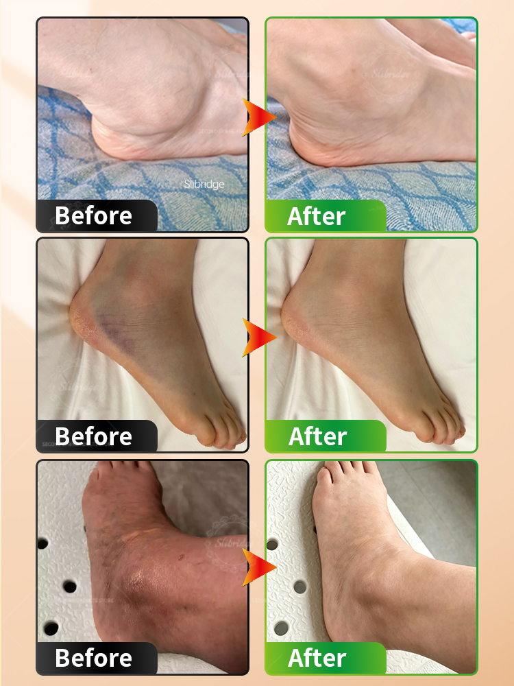 휴대용 발목 온열 마사지기, 무선 진동 온열 보호대,  - Ankle Brace Support 리뷰 및 가격
